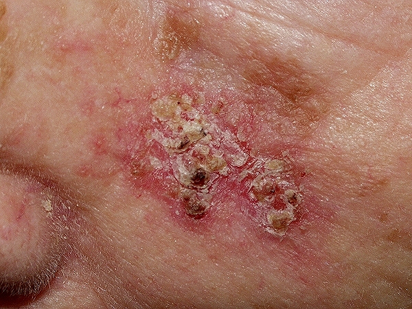 dermatoweb.net